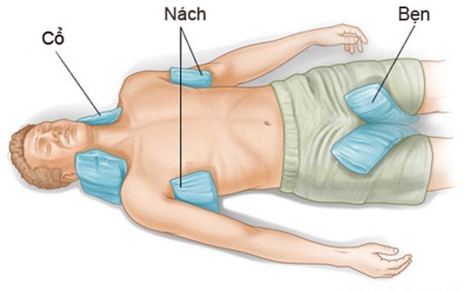 Nguy cơ rối loạn thần kinh, suy đa tạng bởi say nắng