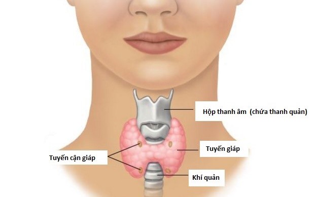 Ai có nguy cơ cao mắc ung thư tuyến giáp?