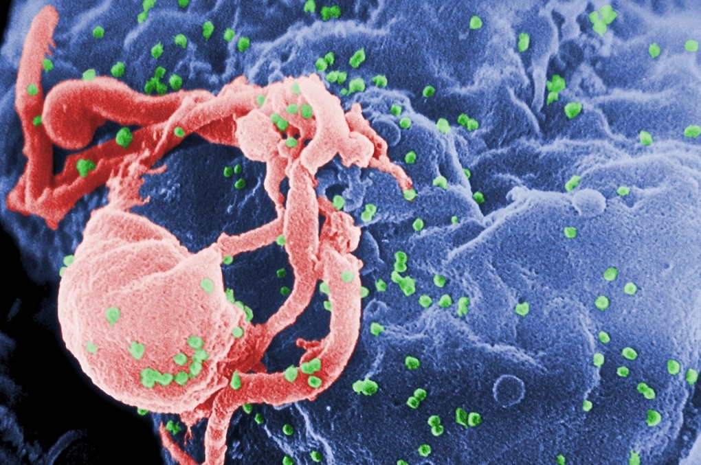 Tìm ra cách tiềm năng chữa khỏi HIV vĩnh viễn
