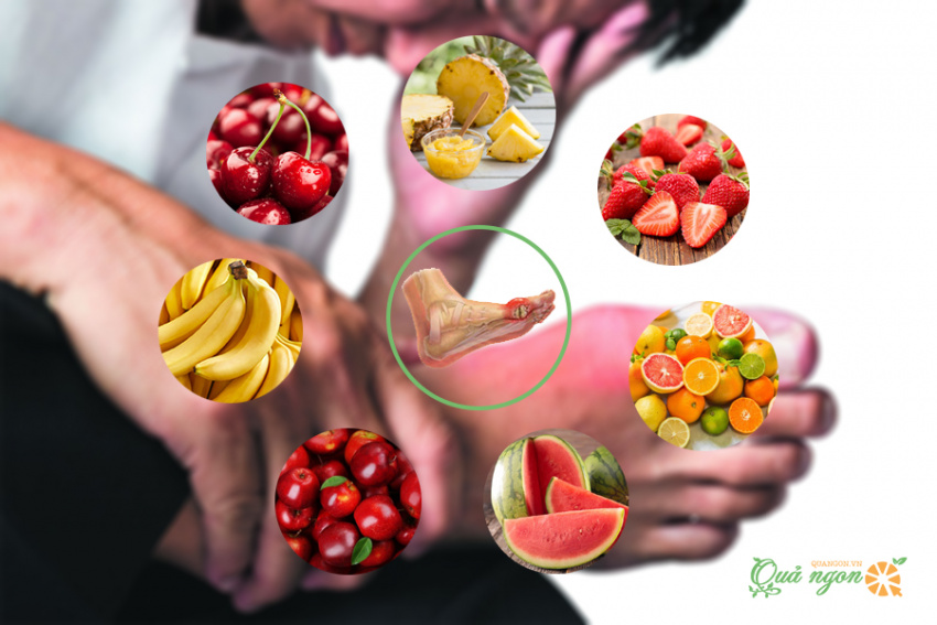 3 loại trái giúp giảm a xít uric tự nhiên cho người bị gout