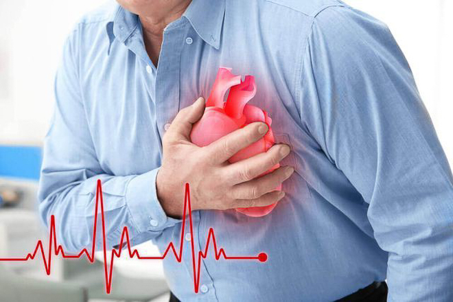 Kiến thức về bệnh mạch vành của người bệnh tim mạch tại Bệnh viện Đa khoa tỉnh Trà Vinh và một số yếu tố liên quan năm 2024