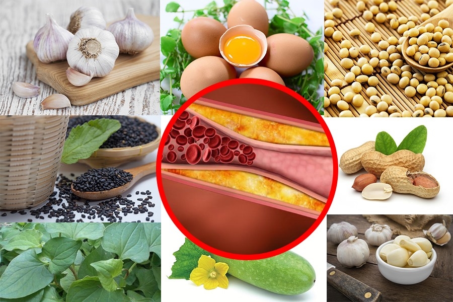 Máu nhiễm mỡ nên kiêng và ăn gì để cải thiện bệnh?