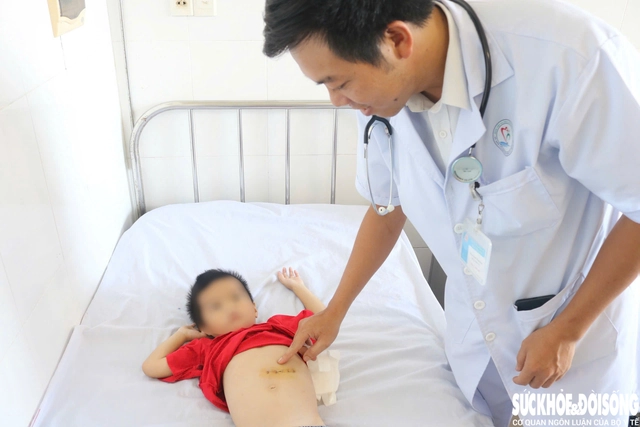 Búi tóc nặng gần nửa cân nằm trong bụng bé trai 5 tuổi