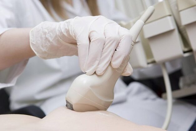 Các loại u vú thường gặp, cách nhận biết sớm nhất