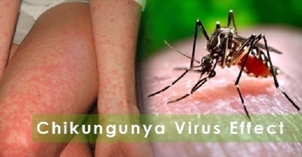 Dịch bệnh Chikungunya tăng tại nhiều nước, Bộ Y tế khuyến cáo khẩn các biện pháp phòng, chống
