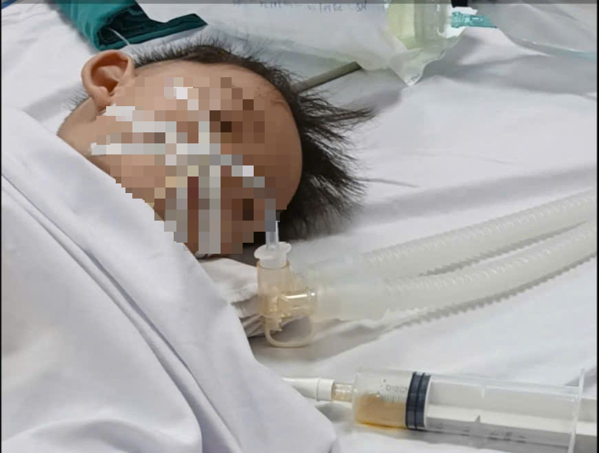 Kỳ tích cứu sống cháu bé 18 tháng tuổi sinh non bị đuối nước