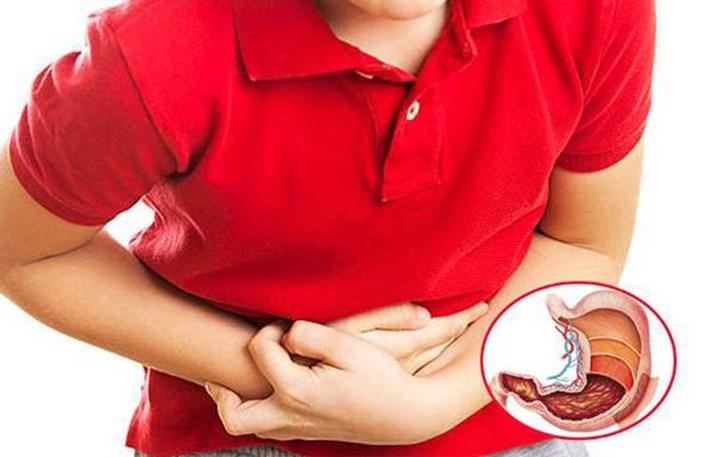 Căng thẳng, stress có gây viêm loét dạ dày không?