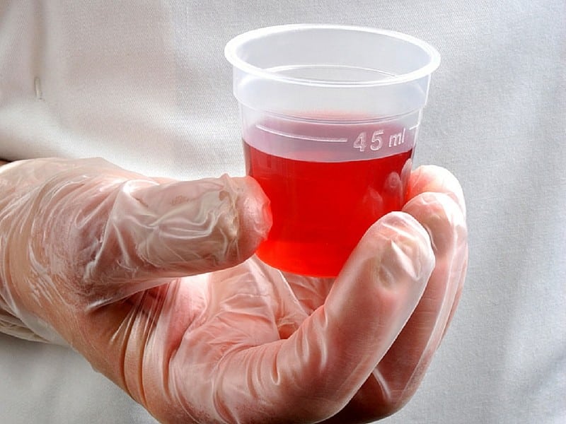 Những điều cần biết khi sử dụng methadon điều trị nghiện chất dạng thuốc phiện