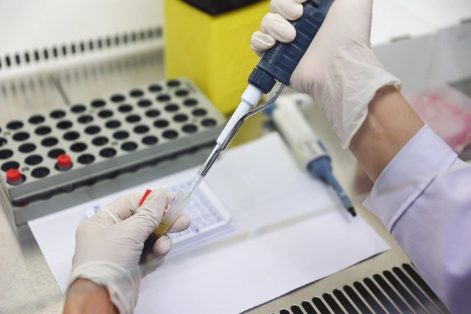 Nhóm 15-29 tuổi chiếm gần nửa số ca HIV mới tại TP HCM Nhóm 15-29 tuổi chiếm gần nửa số ca HIV mới tại TP HCM