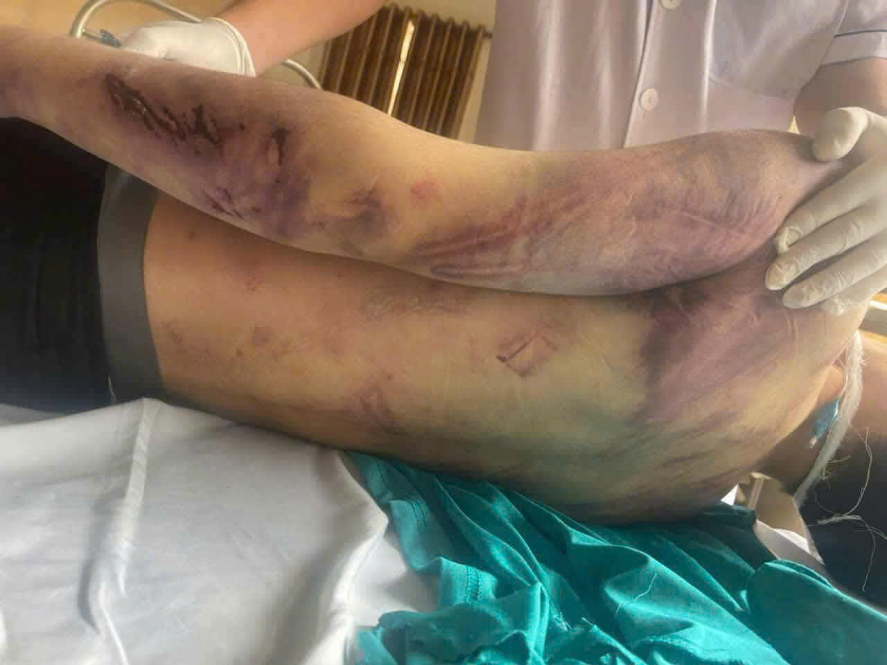 Bộ Y tế yêu cầu kiểm tra, rà soát các cơ sở trợ giúp xã hội trên toàn quốc