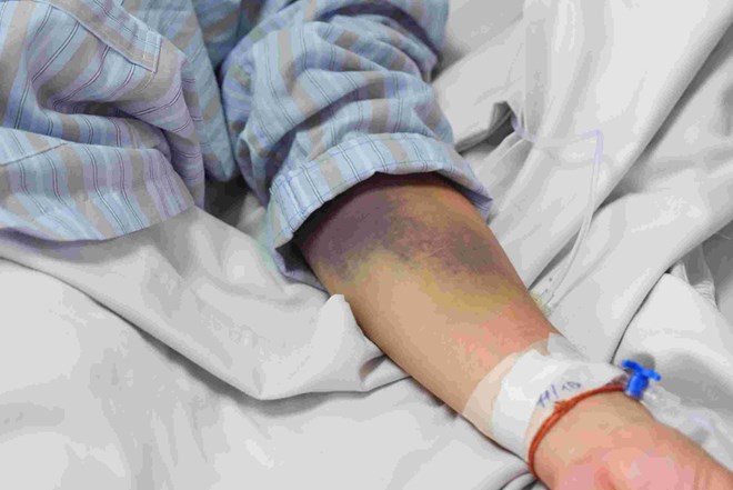 SỰ GẮN KẾT CỦA NHÂN VIÊN Y TẾ VỚI BỆNH VIỆN TÂM THẦN ĐÀ NẴNG NĂM 2024 VÀ MỘT SỐ YẾU TỐ LIÊN QUAN