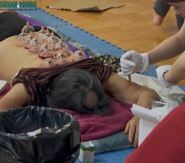 Chuyên gia lên tiếng về 'giác hơi hút máu' ở Hà Nội: Sai chuyên môn, đe dọa sức khoẻ, tính mạng