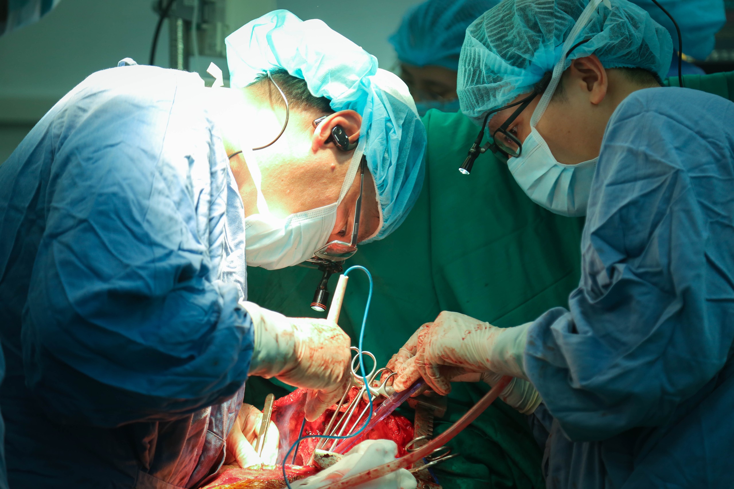 Kỳ tích ghép tạng tại Việt Đức: 21 ca trong một tuần, viết tiếp hành trình hồi sinh
