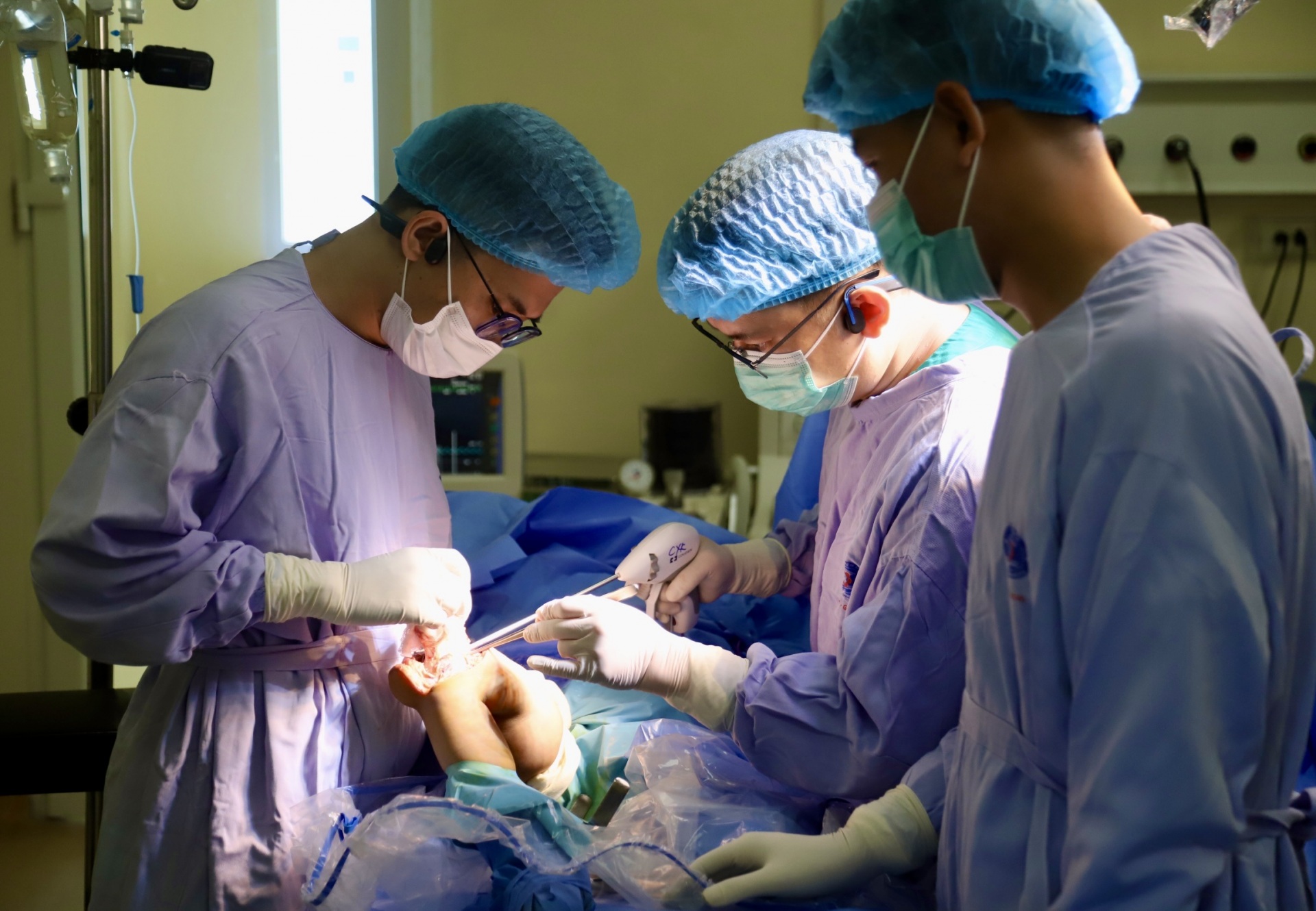 CA BỆNH NHỎ TUỔI NHẤT THỰC HIỆN PHẪU THUẬT THAY KHỚP TĂNG TRƯỞNG NHÂN TẠO TẠI BỆNH VIỆN K - BƯỚC TIẾN CHUYÊN MÔN VƯỢT BẬC CỨU ĐÔI CHÂN BỆNH NHI 6 TUỔI UNG THƯ XƯƠNG ĐÙI CA BỆNH NHỎ TUỔI NHẤT THỰC HIỆN PHẪU THUẬT THAY KHỚP TĂNG TRƯỞNG NHÂN TẠO TẠI BỆNH VIỆN K - BƯỚC TIẾN CHUYÊN MÔN VƯỢT BẬC CỨU ĐÔI CHÂN BỆNH NHI 6 TUỔI UNG THƯ XƯƠNG ĐÙI