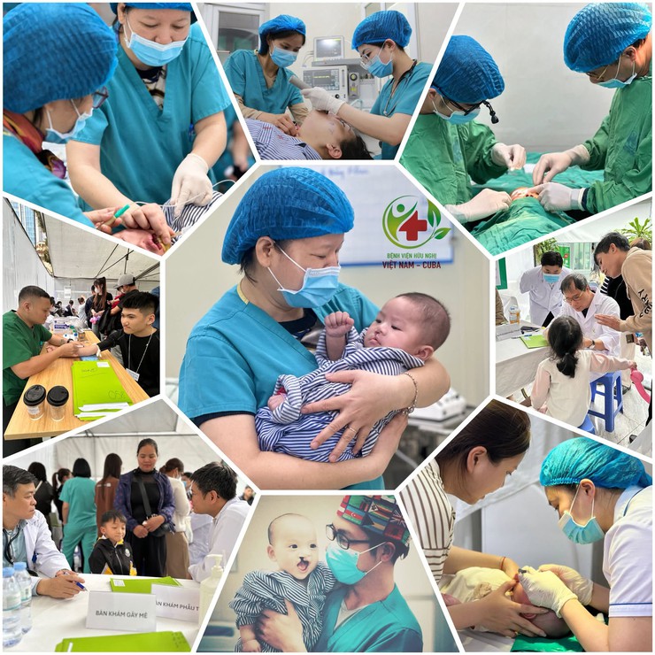 Bệnh viện Hữu nghị Việt Nam - Cu Ba phối hợp triển khai chương trình Phẫu thuật Nụ cười miễn phí cho trẻ em